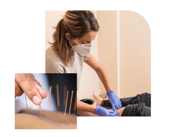 dry-needling-main